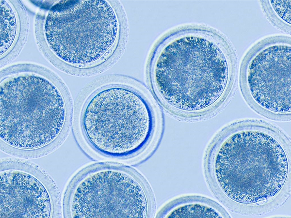 洗涤精子技术是试管中重要的一环