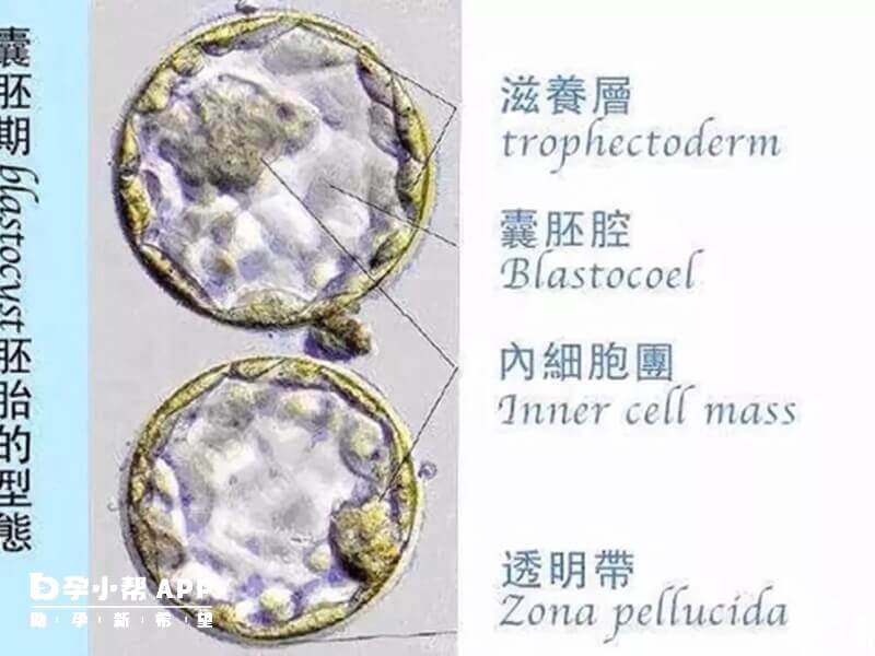 鲜胚移植成功率大概在50%左右