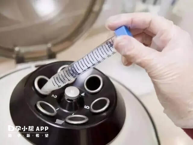 完全死精症做睾丸穿刺不会有活精子