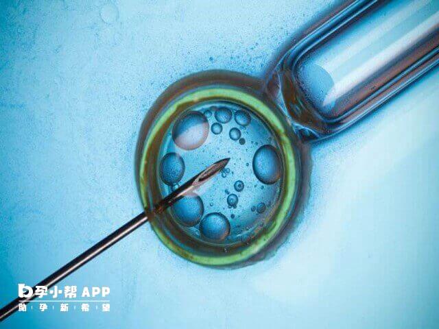 先取卵比先做子宮肌瘤手術比較好