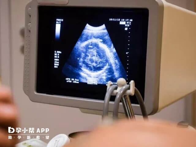 B超是广州早孕检查项目之一