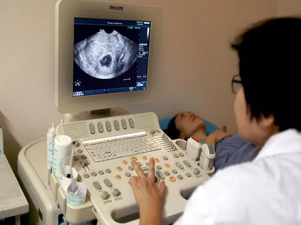 正在做試管二超檢查的女性